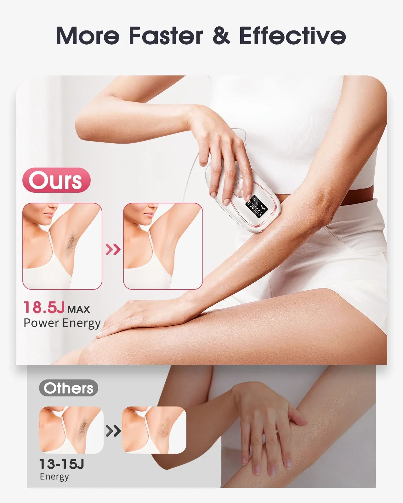 SkinTrimz Flashes IPL ICE Cold Epilator Portable Laser Hair Removal Painless Permanent Hair Remove Bikini Trimmer