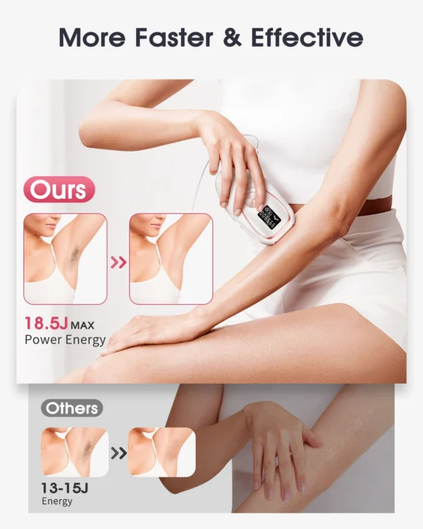 SkinTrimz Flashes IPL ICE Cold Epilator Portable Laser Hair Removal Painless Permanent Hair Remove Bikini Trimmer - Image 6